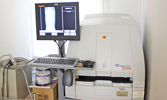 デジタルレントゲン